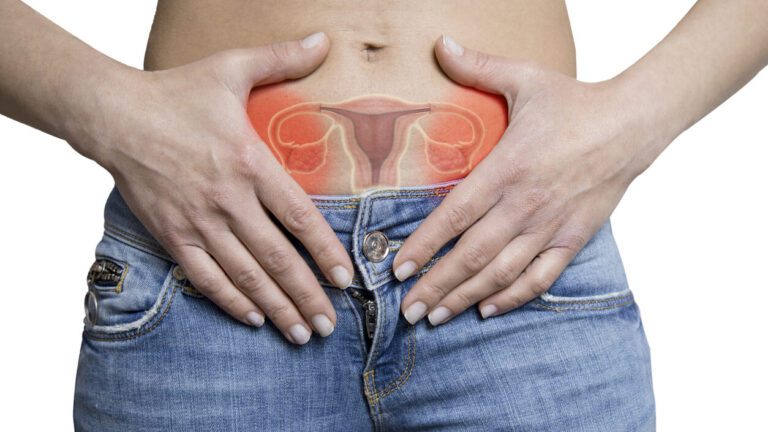 Inchaço abdominal é um dos 4 sintomas do câncer de ovário para ficar atenta