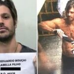 Médica fica com o rosto desfigurado após procedimento estético de R$ 8 mil: “Deu tudo errado”