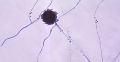 Fungo capaz de ‘devorar’ humanos pode se espalhar devido ao aquecimento global