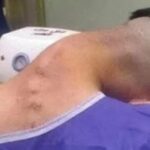 Saiba quais são os sintomas da doença que matou atriz mirim