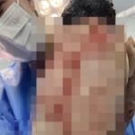 Esposa mata próprio marido e cozinha órgão genital com feijão