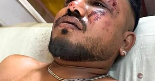 O que se sabe sobre o único sobrevivente da queda de avião que matou mais de 240 na Índia